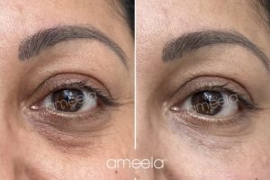 1000074880 1000074880