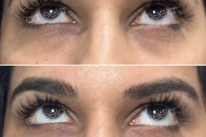 1000074883 1000074883