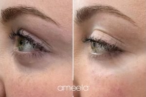 1000074886 1000074886