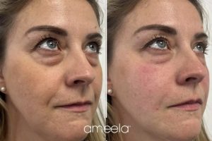 1000074889 1000074889