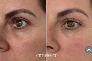 1000074892 1000074892