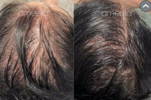 1000074895 1000074895